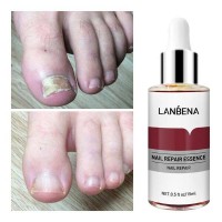 LANBENA Nail Repair Essence Serum Fungal Nail Treatment Remove Onychomycosis Toe Nourishing Brighten Hand Foot Skin Care